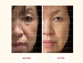 ラクレア(LA KULEA)/リフトアップ・小顔フェイシャル