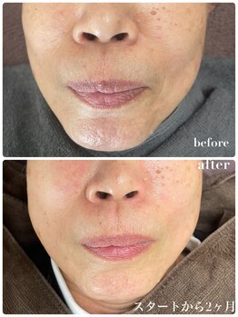 ペリドット(Peridot)/ルナシューネ化粧品