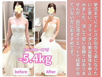 なかしま鍼灸整骨院/30代ブライダル実績(痩身/整体)