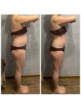 スタイル(Style.)/ビフォーアフター