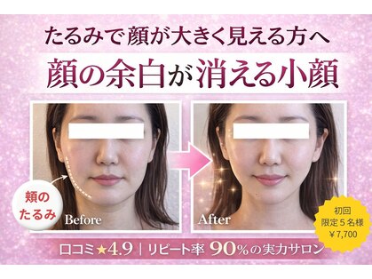 シアワセ(shiAwase)の写真