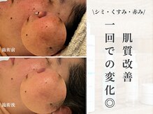 サンラックスサロン 岐阜(SANlux Salon)