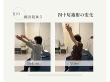 ビオ(BiO)