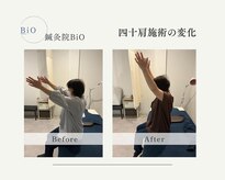 ビオ(BiO)