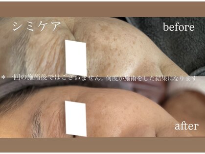 アイラッシュアンドビューティー ムージャドール(Mu Jadore)の写真