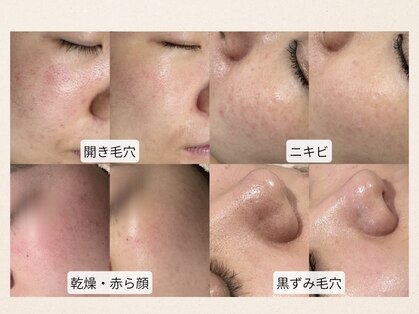 ホワイトラボ 梅田(White labo)の写真