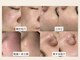 ホワイトラボ 梅田(White labo)の写真