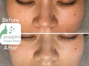 メゾンビューティーポピンズ 恵比寿(maisonbeauty poppins)/ブライダルフルコース