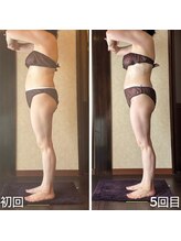 アーユルヴェーダアンドアロマエステ アユス(AYUS)/【５０代】痩身