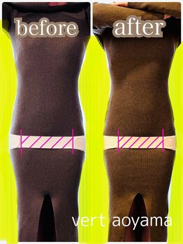 ヴェール 青山(vert)/骨盤矯正【股関節がポイント】