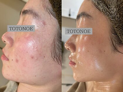 トトノエ(TOTONOE)の写真