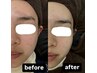 クリアな美肌☆シミくすみ徹底ケア【日焼け止め６日分付】