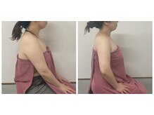 ブリランテ(Brillante)/4回目beforeafter