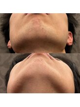 フェリーバ(FELIVA)/こんなにもお綺麗に！