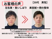 サロンスマイル/30代美容鍼ビフォーアフター