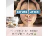 【ダウンタイム無し!】エクソソームハーブピーリング 50分