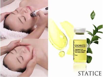 スターティス(STATICE)の写真