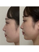 美骨矯正サロン メディカルカイロテルボ 高田馬場店/脳圧調整&小顔矯正