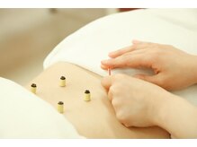 ほねつぎ長嶺鍼灸接骨院/指が届かないところには鍼灸が！