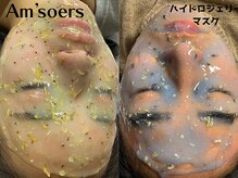 エムソエル(Am'soers)の雰囲気（オプションでマスクを選んでいただいた方にはスカルプケア付き★）