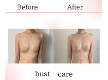 サロンツキ(salon tuki)/バストアップ