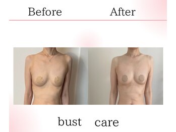 サロンツキ(salon tuki)/バストアップ