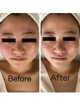 ミンク(Mink)/小顔◎赤みにも♪