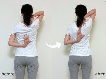 エーアール(AR)/【Before/After】