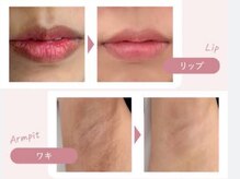 アンジェロ(Angelo)の雰囲気（肌にやさしく、印象は華やか。ローマピンクで叶える肌）