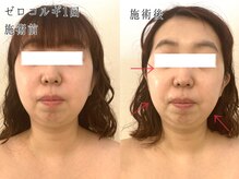 サロン カピリナ(salon Kapilina)/【before→after】