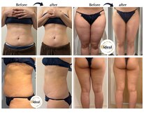 アイディール(ideal)