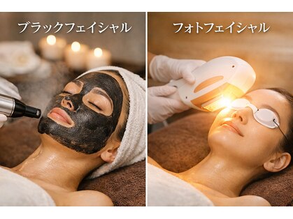 プレシャス(Precious)の写真