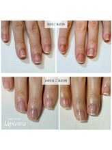 ネイルサロン ラピエトラ(la pietra)/最強のネイルケア３ケ月間コース