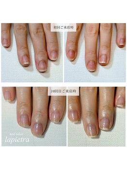 ネイルサロン ラピエトラ(la pietra)/最強のネイルケア３ケ月間コース