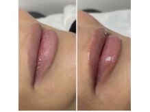 リラクゼーションアンドビューティーボヌール(BONHENR)/JETPEELの効果