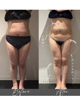 インフィニーズ(INFINEEZ)/カスタマイズ120分痩身30代