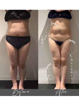 インフィニーズ(INFINEEZ)/カスタマイズ120分痩身30代