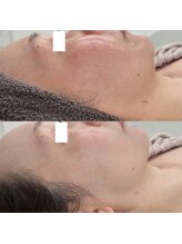 ヴェルシック(Belchic)/くすみ・むくみを瞬時に解消