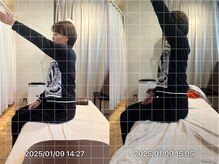 グレフル鍼灸接骨院 整体院 心斎橋/50肩／40肩／肩甲骨はがし／整体