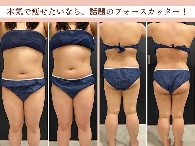 スパチャーレ(Spa ciare)｜ホットペッパービューティー