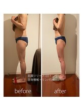 バンブー(bamboo)/ビフォーアフター