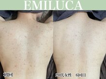 エミルカ 名古屋(EMILUCA)