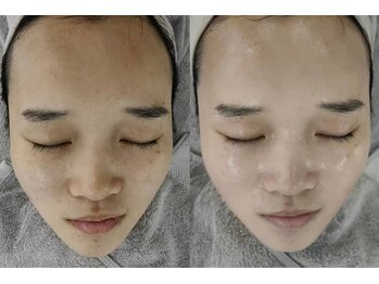 ベル(Bell)/ダイヤモンドスピキュール