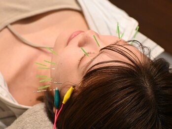りんどう鍼灸整骨院の写真/年齢が出やすい"ほうれい線"やたるみに…＼美容鍼×ララピール／で内と外にWでアプローチ☆