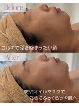 モア 星ヶ丘店(MORE)/小顔コルギ