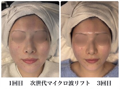 サロンドール(Salon doll)の写真