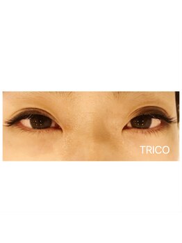 トリコ 狛江(TRICO by hair make passage)/レーザーラッシュ取り扱い