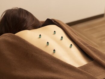 コピット(copitto)/お灸で体の芯から健康へ