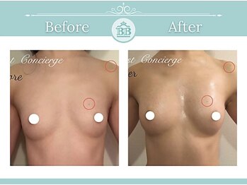 美人バスト 掛川店/【バストアップ/育乳静岡/掛川】