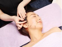 シー バイ カリスタ 表参道店(C by CALISTA)/肌の負担を最小限にした美容鍼